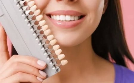 Karbonatla diş beyazlatmanın riskleri: Uzmanlardan uyarılar