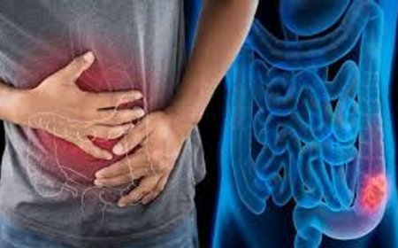 Kolon kanseri 20 yaşa düştü