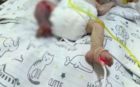 Yanlış Tedavi : 26 Haftalık Ömer Bebeğin Sağlık Durumu İnceleme Altında