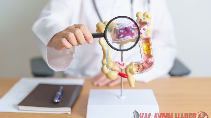 GÜNÜMÜZÜN EN YAYGIN SİNDİRİM SORUNLARINDAN “İRRATABL BAĞIRSAK SENDROMU”