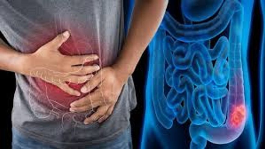 Kolon kanseri 20 yaşa düştü