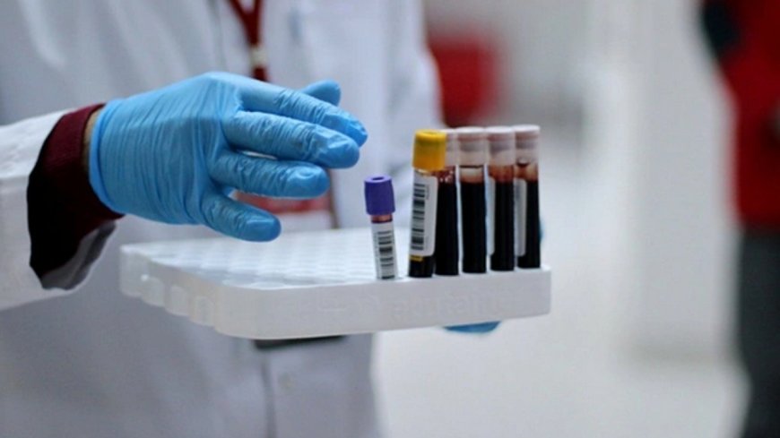 Bu kan grubundan olanlar dikkat! Bunamaya daha yatkın oluyorlar