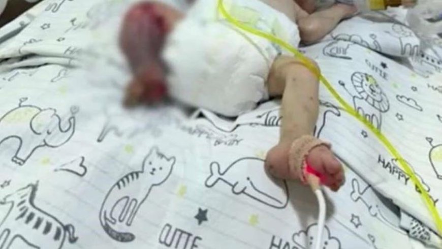 Yanlış Tedavi : 26 Haftalık Ömer Bebeğin Sağlık Durumu İnceleme Altında