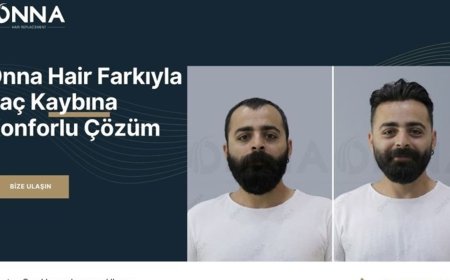 Onna Hair Güvencesiyle Saçlarınıza Yeniden Ulaşın!
